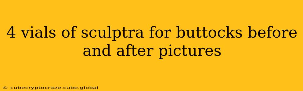 4 vials of sculptra for buttocks before and after pictures