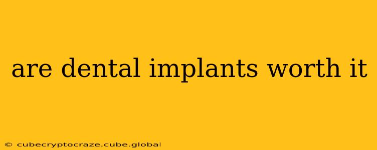 are dental implants worth it