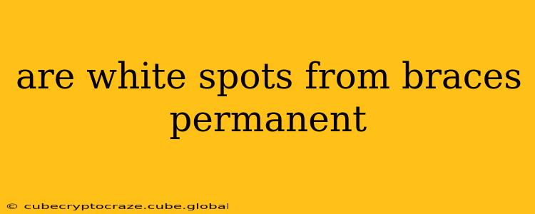 are white spots from braces permanent