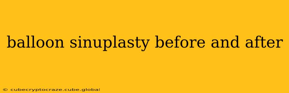 balloon sinuplasty before and after