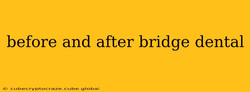 before and after bridge dental