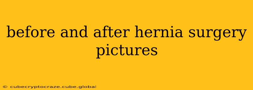 before and after hernia surgery pictures