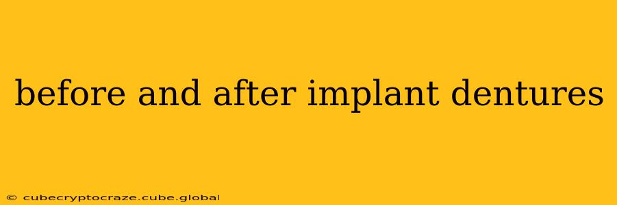 before and after implant dentures
