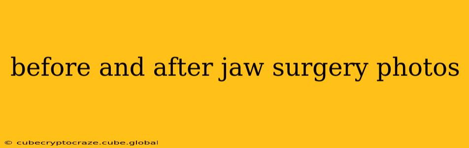 before and after jaw surgery photos
