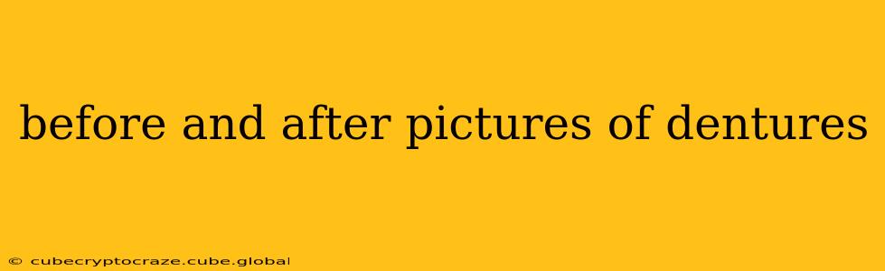 before and after pictures of dentures
