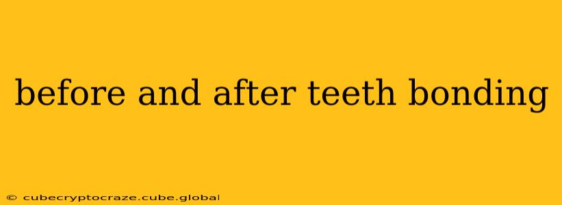 before and after teeth bonding