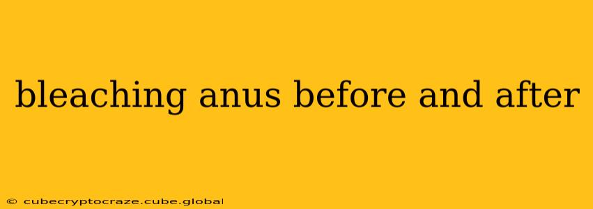 bleaching anus before and after