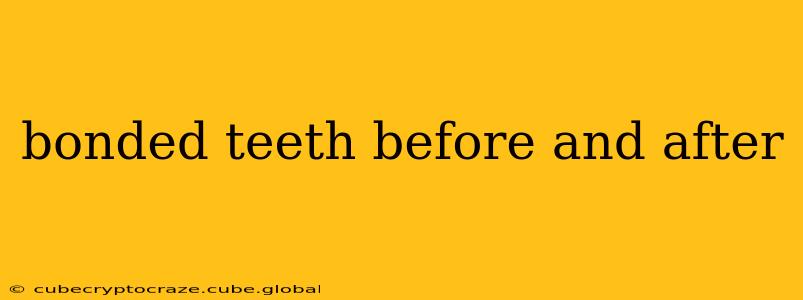 bonded teeth before and after