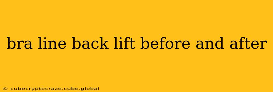 bra line back lift before and after