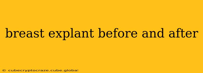 breast explant before and after