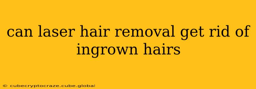 can laser hair removal get rid of ingrown hairs