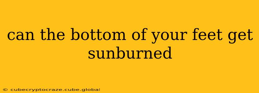 can the bottom of your feet get sunburned