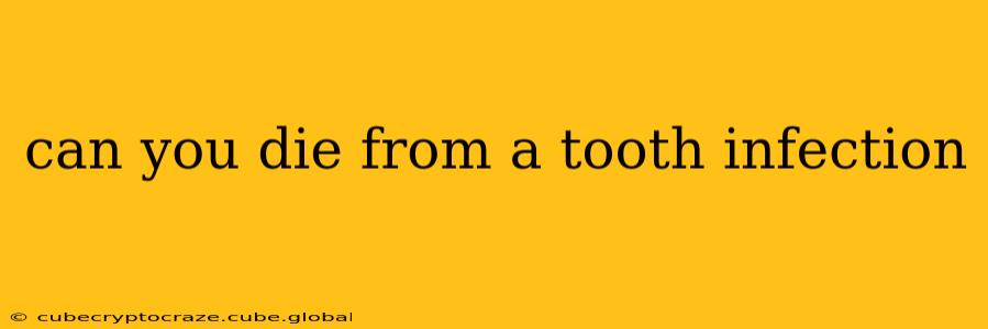 can you die from a tooth infection