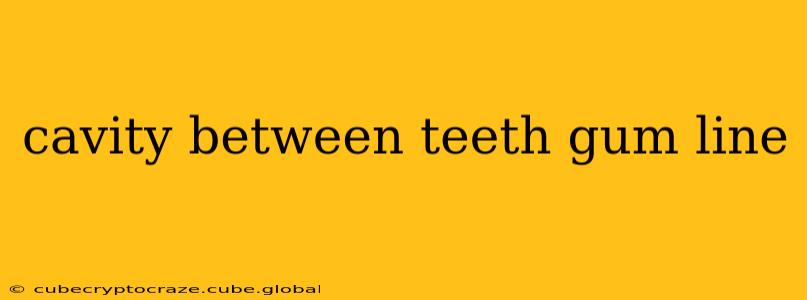 cavity between teeth gum line