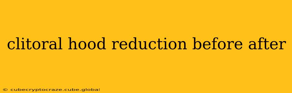 clitoral hood reduction before after