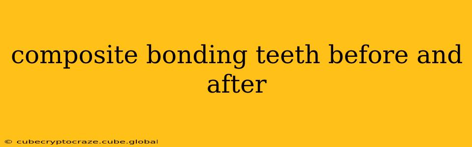 composite bonding teeth before and after