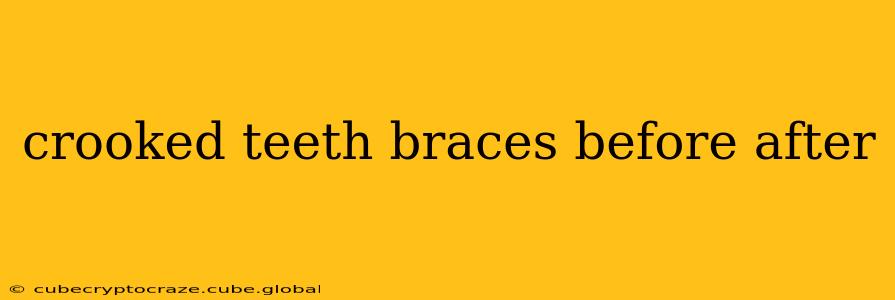 crooked teeth braces before after