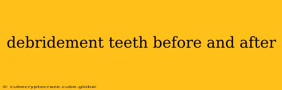 debridement teeth before and after