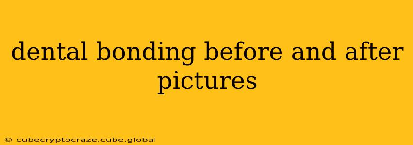 dental bonding before and after pictures
