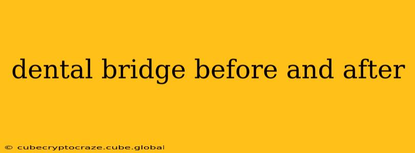 dental bridge before and after