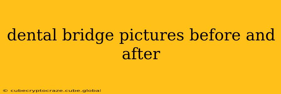 dental bridge pictures before and after