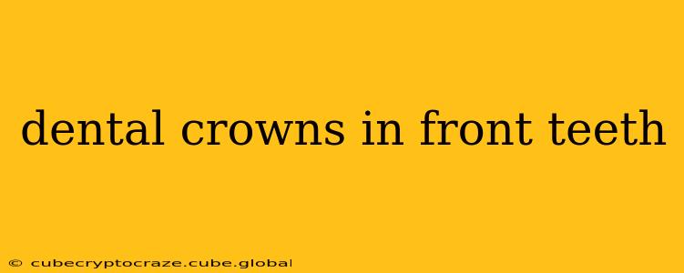 dental crowns in front teeth