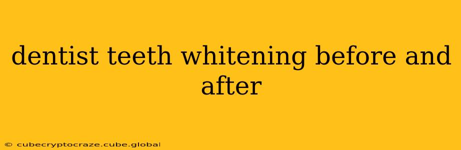 dentist teeth whitening before and after