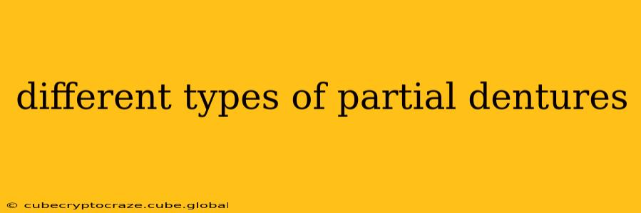 different types of partial dentures