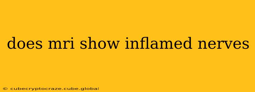 does mri show inflamed nerves