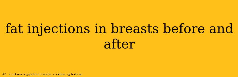 fat injections in breasts before and after