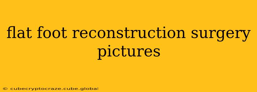 flat foot reconstruction surgery pictures