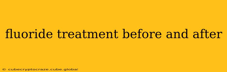 fluoride treatment before and after