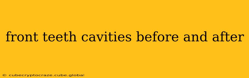 front teeth cavities before and after
