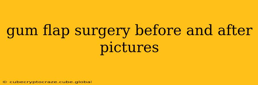 gum flap surgery before and after pictures
