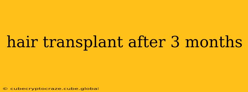 hair transplant after 3 months