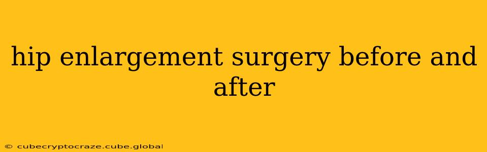 hip enlargement surgery before and after