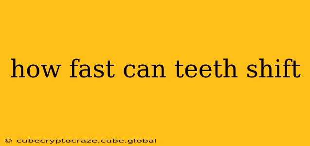how fast can teeth shift