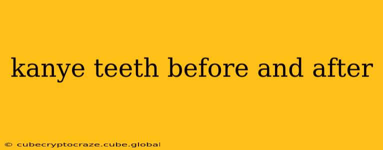 kanye teeth before and after