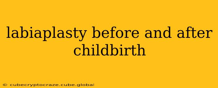 labiaplasty before and after childbirth