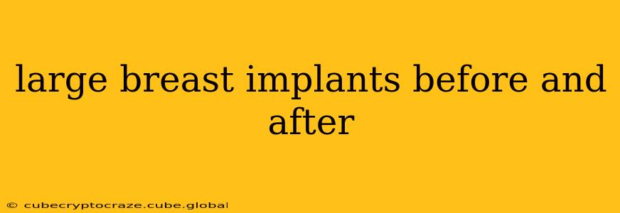 large breast implants before and after
