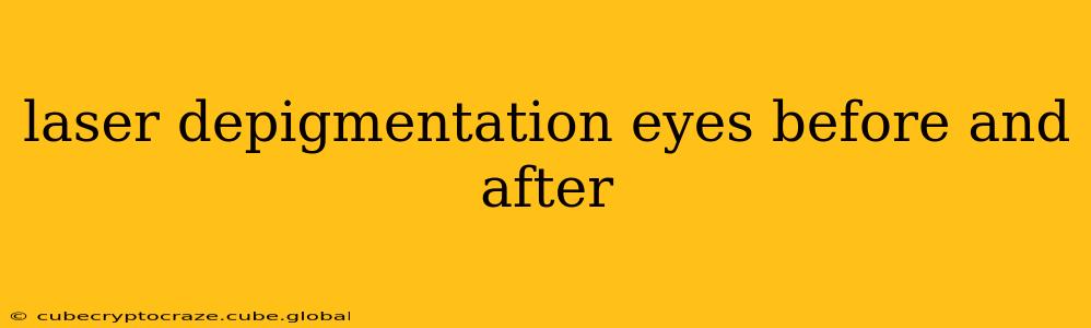 laser depigmentation eyes before and after