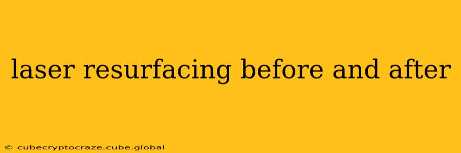 laser resurfacing before and after