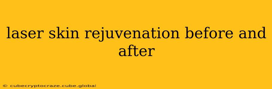 laser skin rejuvenation before and after