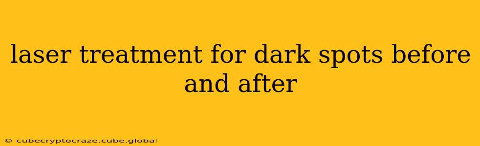 laser treatment for dark spots before and after