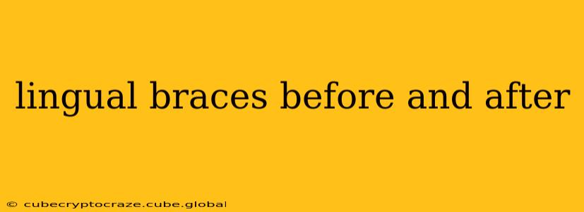 lingual braces before and after