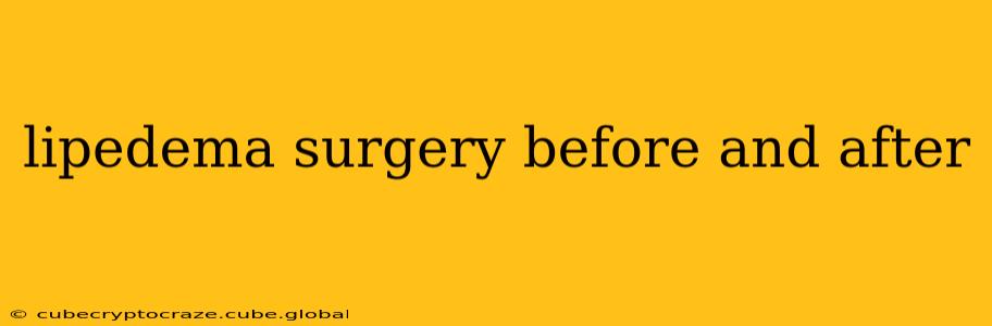 lipedema surgery before and after