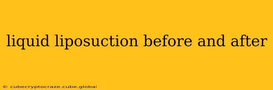liquid liposuction before and after