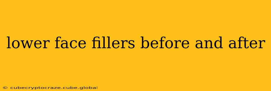 lower face fillers before and after