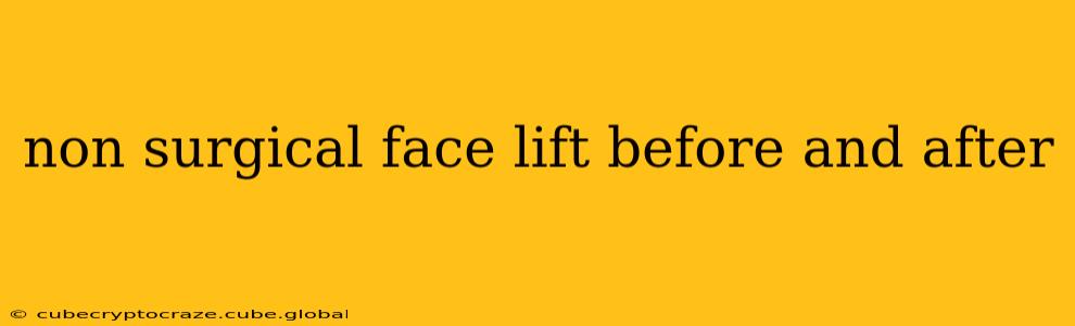 non surgical face lift before and after