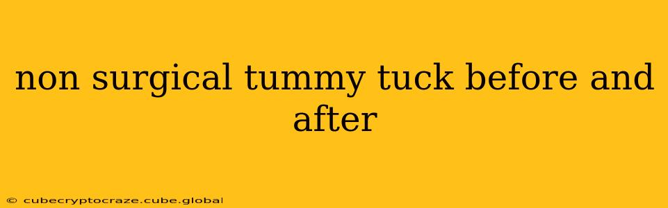 non surgical tummy tuck before and after